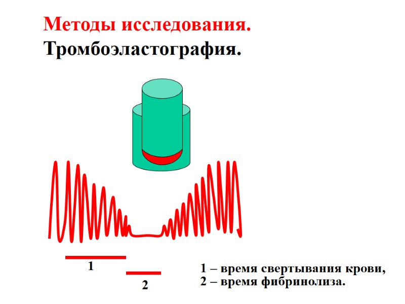 Методы исследования. Тромбоэластография. 1 2 1 – время свертывания крови, 2 – время фибринолиза.